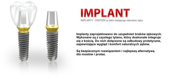 Implanty osstem